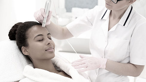 micro-needling-1-489x275.jpg