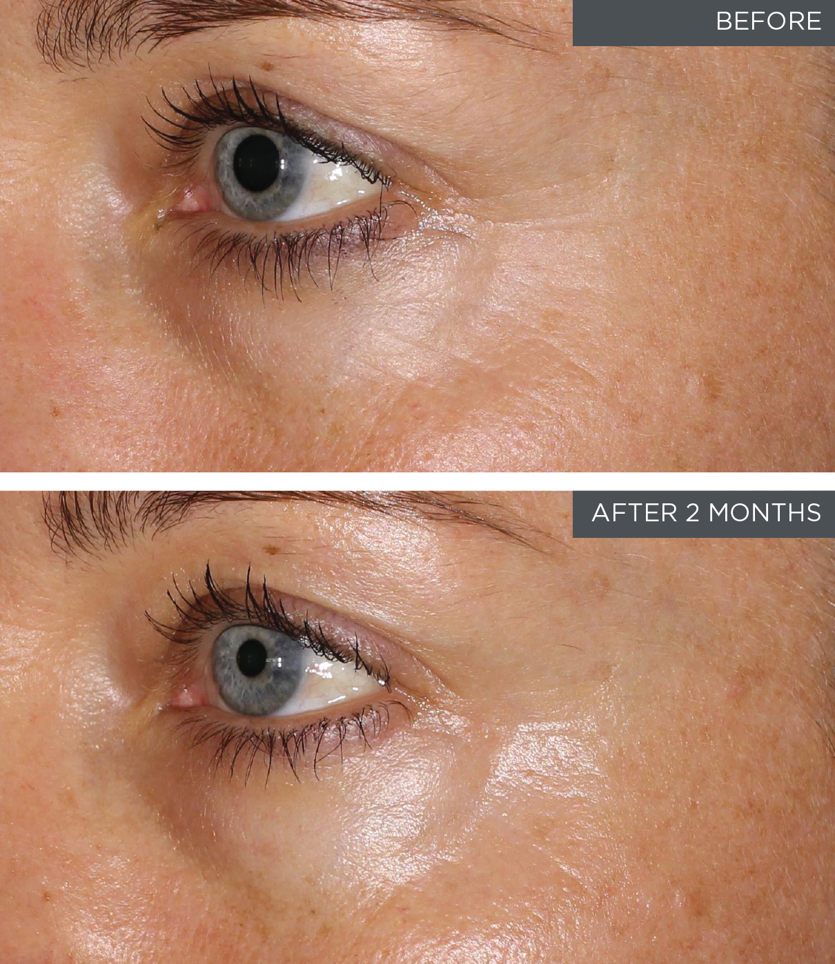 Environ-fine-lines-and-dehydration